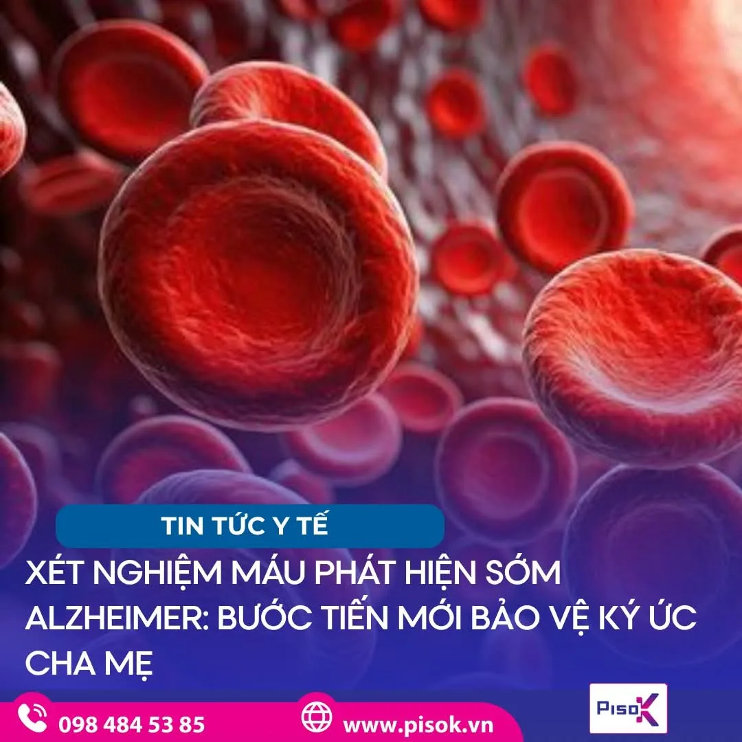 Xét nghiệm máu phát hiện sớm bệnh Alzheimer